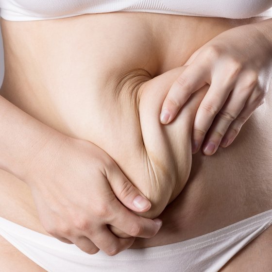 abdominoplasty or tummy tuck amaryllis clinic plastic surgery abu dhabi 1761563122