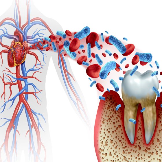 gum and periodontal treatment amaryllis german clinic best dental clinic in abu dhabi