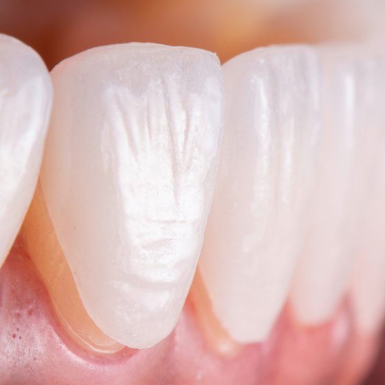 smile design amaryllis german clinic best dental clinic in abu dhabi