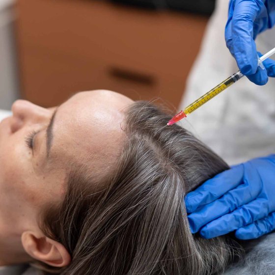 hair treatment amaryllis clinic plastic surgery dr. chris reuter german plastic surgeon in abu dhabi 1