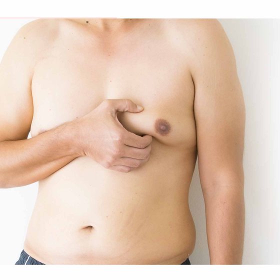 gynecomastia man breast surgery amaryllis clinic plastic surgery abu dhabi 00