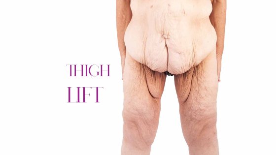 thigh lift amaryllis clinic plastic surgery abu dhabi dr. chris reuter german plastic surgeon 1761563334