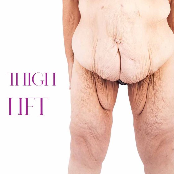 thigh lift amaryllis clinic plastic surgery abu dhabi dr. chris reuter german plastic surgeon